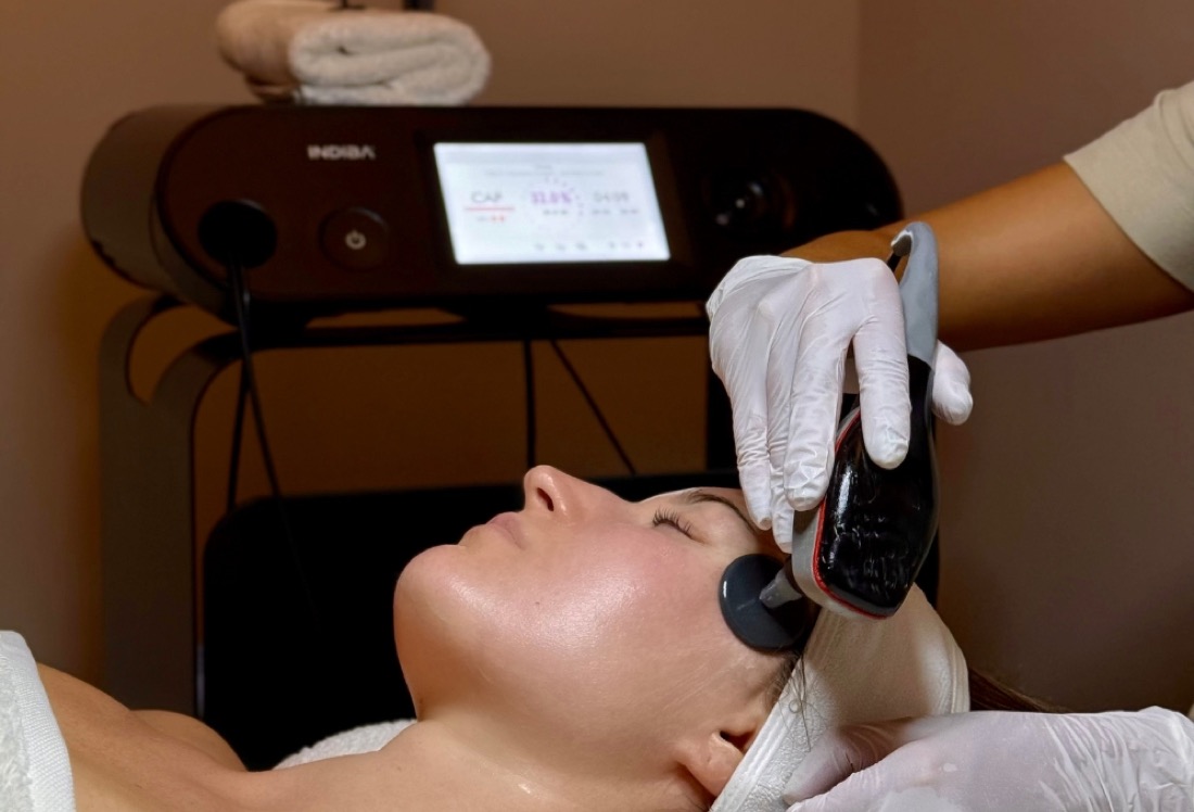 Tratamiento facial con el equipo Indiba Pro Max de radiofrecuencia